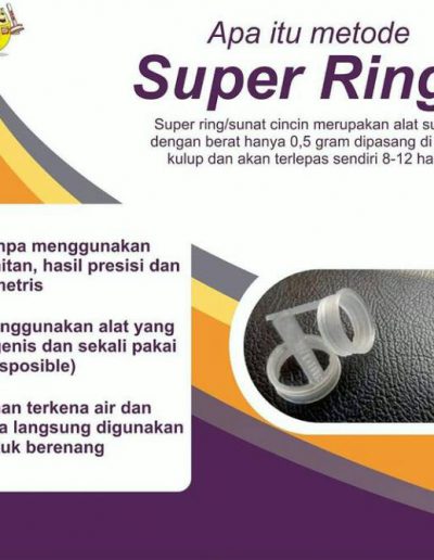 galery-sunat-super-modern